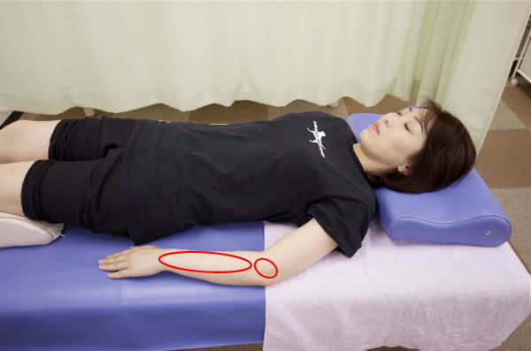 テニス肘(肘の外側の痛み)に対する施術部分